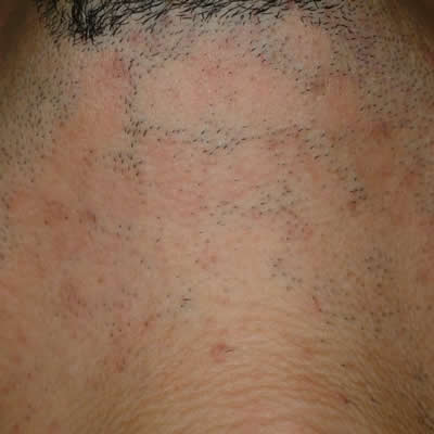 permanent ahir removals kzn