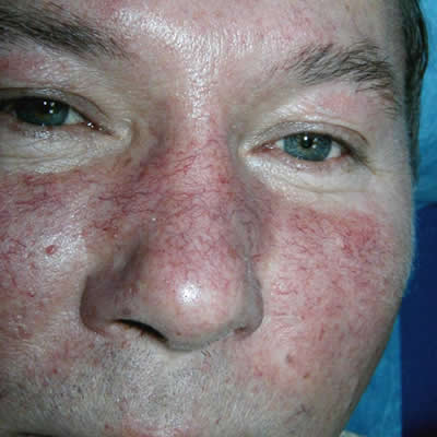 skin rejevnation clinics durban skin rejevnation clinics durban