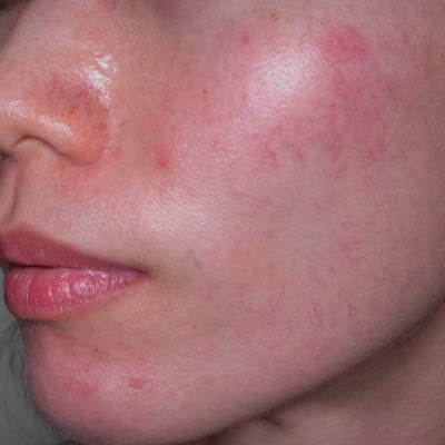 skin clinics skin clinics