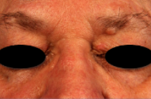 skin treatments