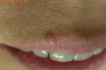 belladerma