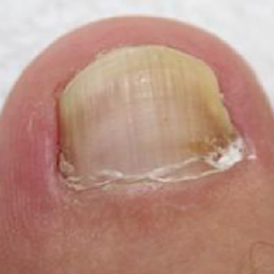 nail treatment kloof