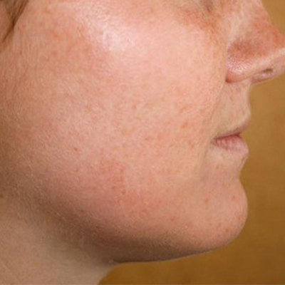 skin whitening products