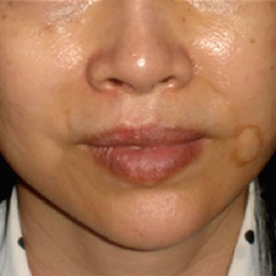 wkin whitening durban
