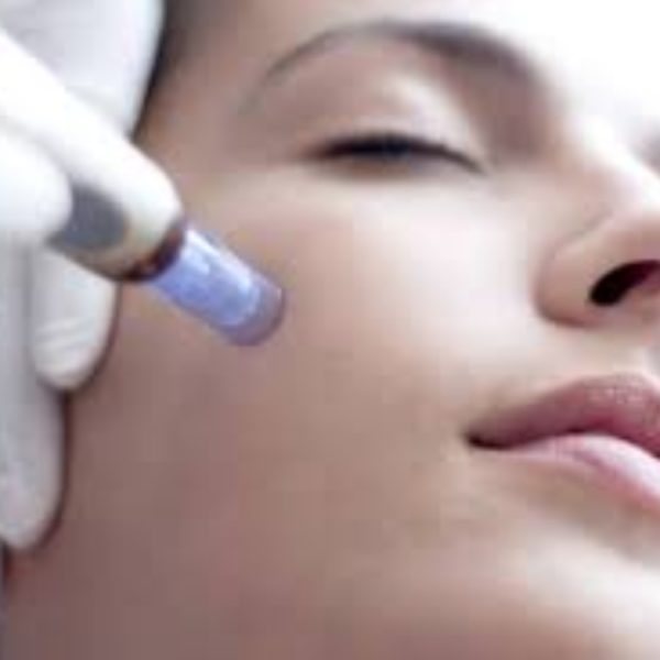 Microneedling-pic