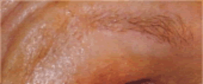 Brow1 Brow1