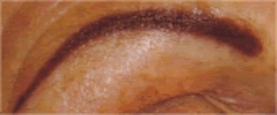 Brow2 Brow2