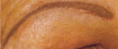 Brow3 Brow3