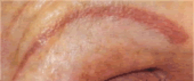 Brow4 Brow4